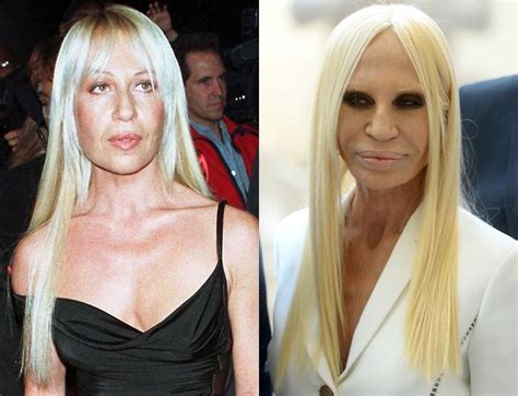 donatella versace worth|Donatella Versace plastic surgery.